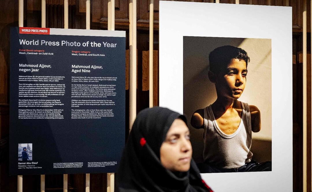 La foto de Mahmoud Ajjour, un niño palestino que perdió ambos brazos por la guerra en Gaza, ganó el World Press Photo 2025. Foto: AFP