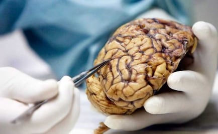 Hallan en Múnich restos de víctimas de experimentos científicos nazis