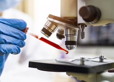 Coronavirus: cómo la tecnología ARNm puede abrir las puertas a una vacuna contra el cáncer