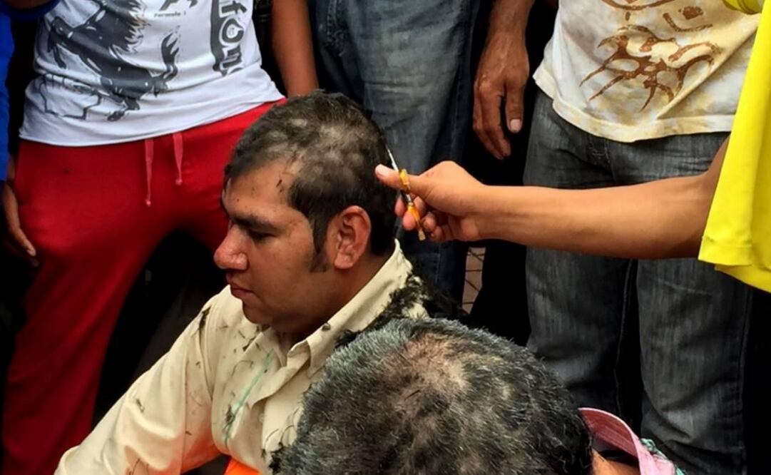 The hair was forcibly cut off several of them as a crowd watched. (Photo: Fredy Martín Pérez EL UNIVERSAL)