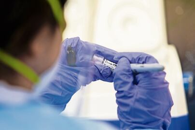 Suman 5 los países africanos que reportan brotes de ántrax; se reportan 20 muertes este año por la enfermedad 