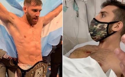 Peleador de MMA recibe balazo al frustrar robo de su moto