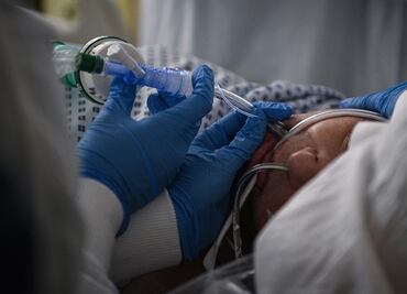 El Covid-19 puede dañar los dos pulmones y provocar neumonía bilateral