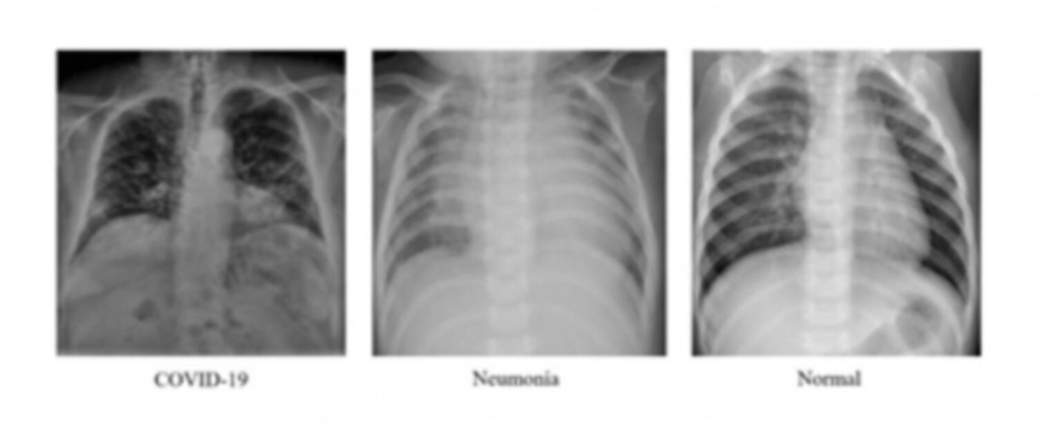 Universitarios mexicanos usan inteligencia artificial para detectar Covid