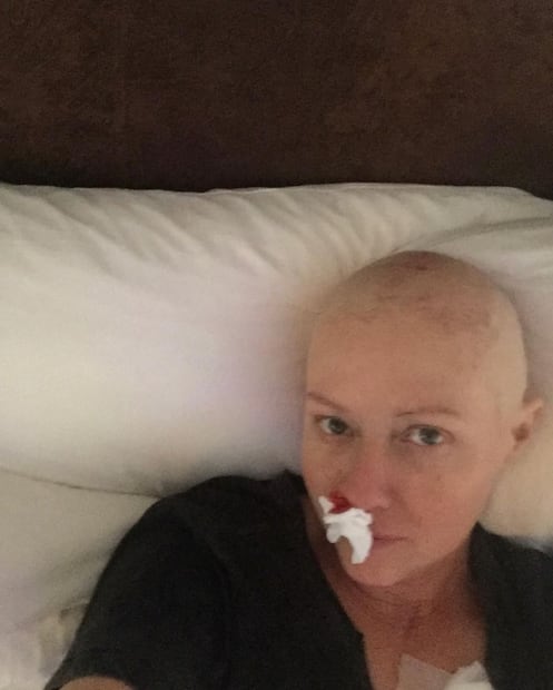 Las fotos de Shannen Doherty que muestran su fortaleza contra el cáncer
