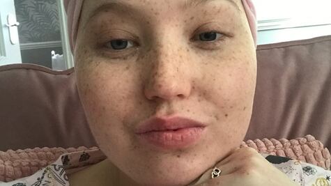 "No tenía idea de que mi infección en el pecho era leucemia"