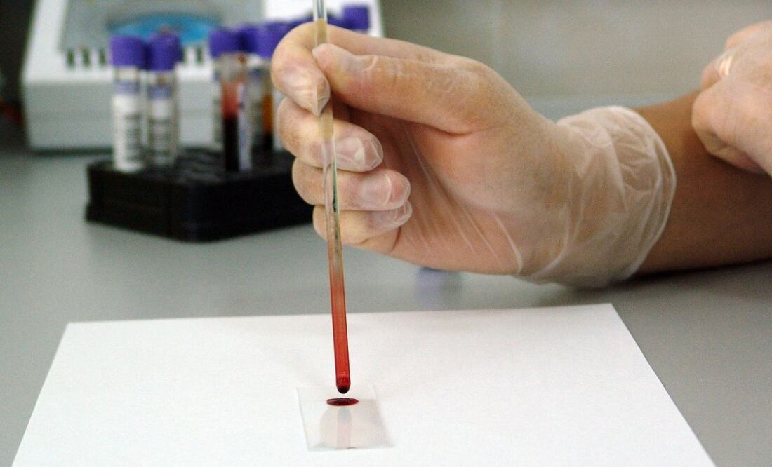 Caupí y colesterol. Fuente: Pixabay Conicet