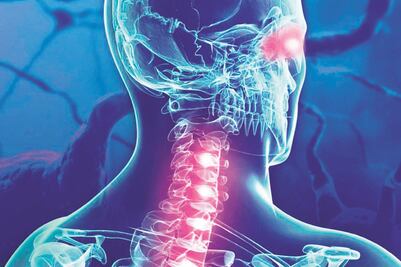 Esclerosis múltiple: enfermedad desmielinizante 