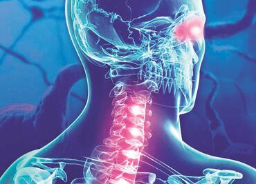 Esclerosis múltiple: enfermedad desmielinizante