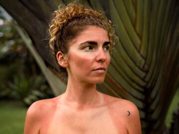 La planta que alivia las quemaduras de sol en la piel