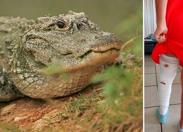 Niña enfrenta a caimán se salva de ser mordida