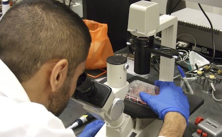 OMS planea erradicar rabia en humanos