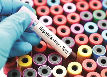 México, lejos de eliminar la hepatitis: aumentan los casos en 48%