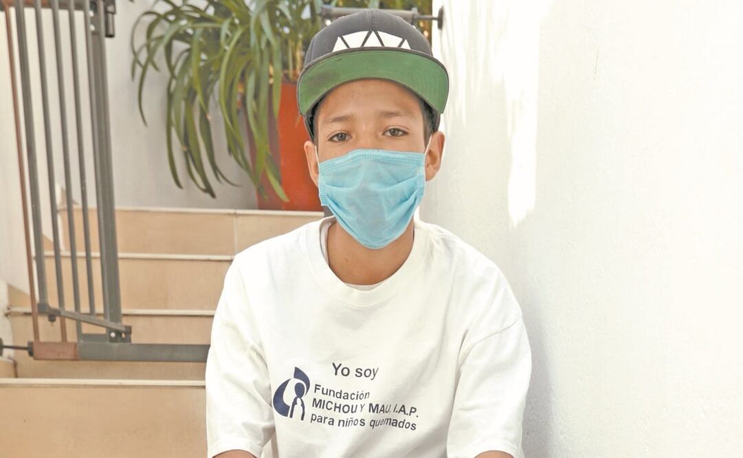 En la vida real, Ángel Leonel Corral perdió el antebrazo por la explosión de un transformador. Foto: Archivo/ El Universal