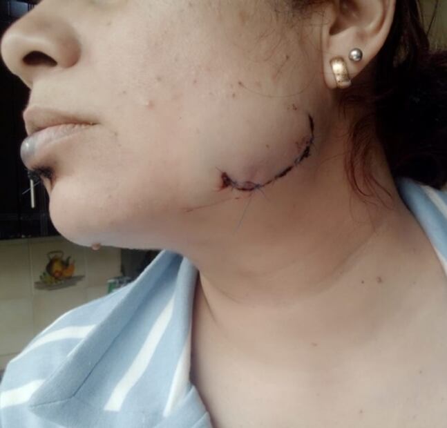 "Sabes de parte de quién es"; a Jennifer le cortaron la cara, sospecha de su ex