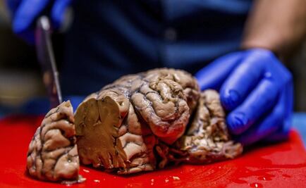 Hospital psiquiátrico almacena 3 mil cerebros para investigación