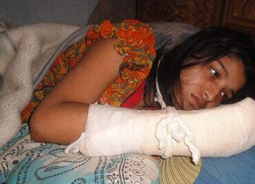 Hombre en Bangladesh le corta los dedos a su esposa para evitar que estudie