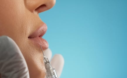 ¿Pensando en usar fillers? Aquí está todo lo que necesitas saber