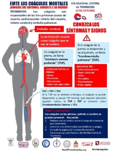 Alertan sobre cifras de decesos por trombosis