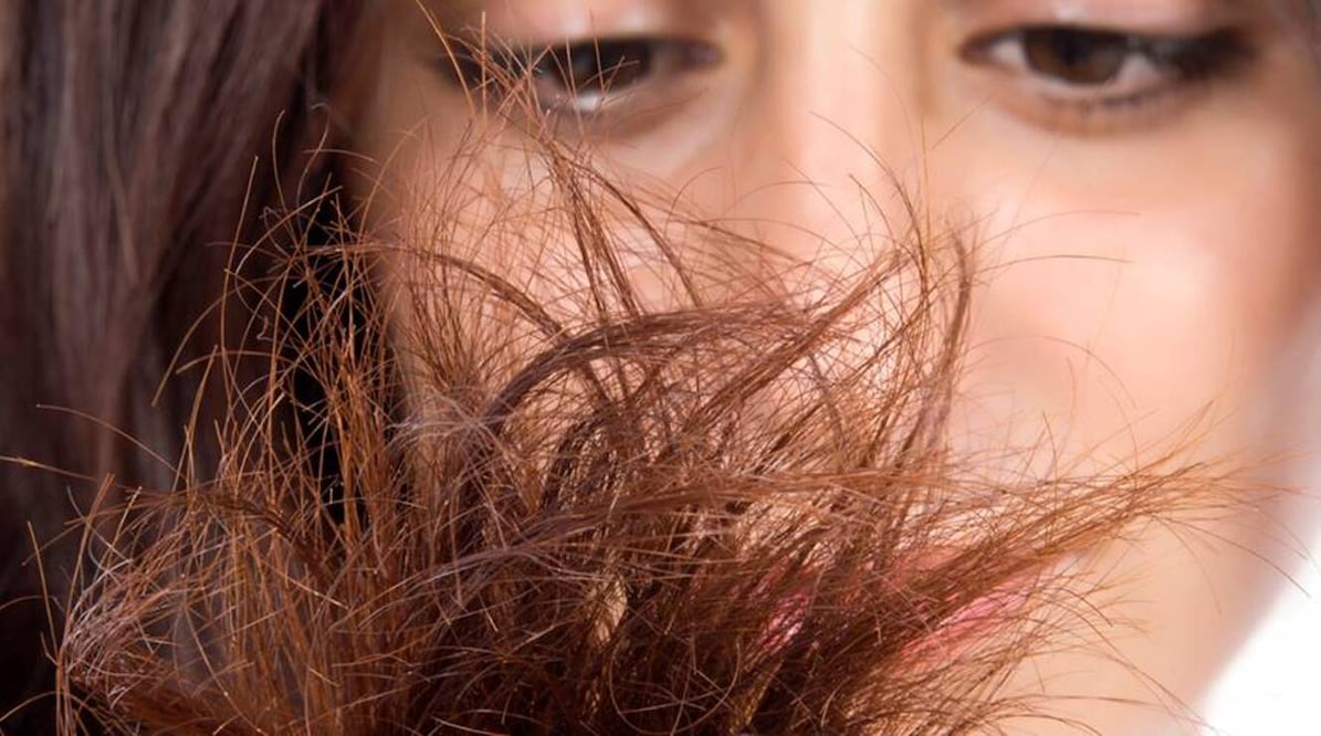 La orzuela hace que el cabello luzca seco y apelmazado. Foto: Garnier