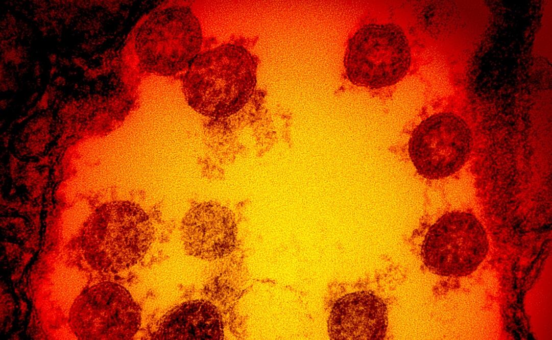 Foto: AFP /NATIONAL INSTITUTE OF ALLERGY AND INFECTIOUS DISEASES/HANDOUT 