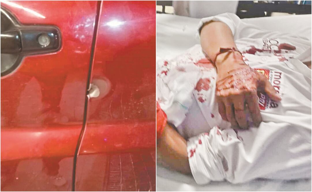 Francisco Pancoatl fue atacado a tiros en el puente de Chalchihuapan; resultó herido de bala en una mano. Fotos: ESPECIAL