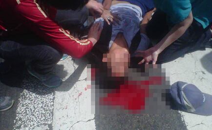 Joven es herido de bala durante marcha opositora en Caracas