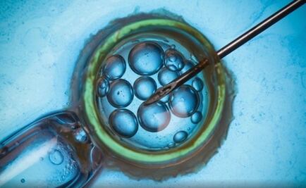 Error en Holanda: 26 inseminadas con esperma de un sólo hombre