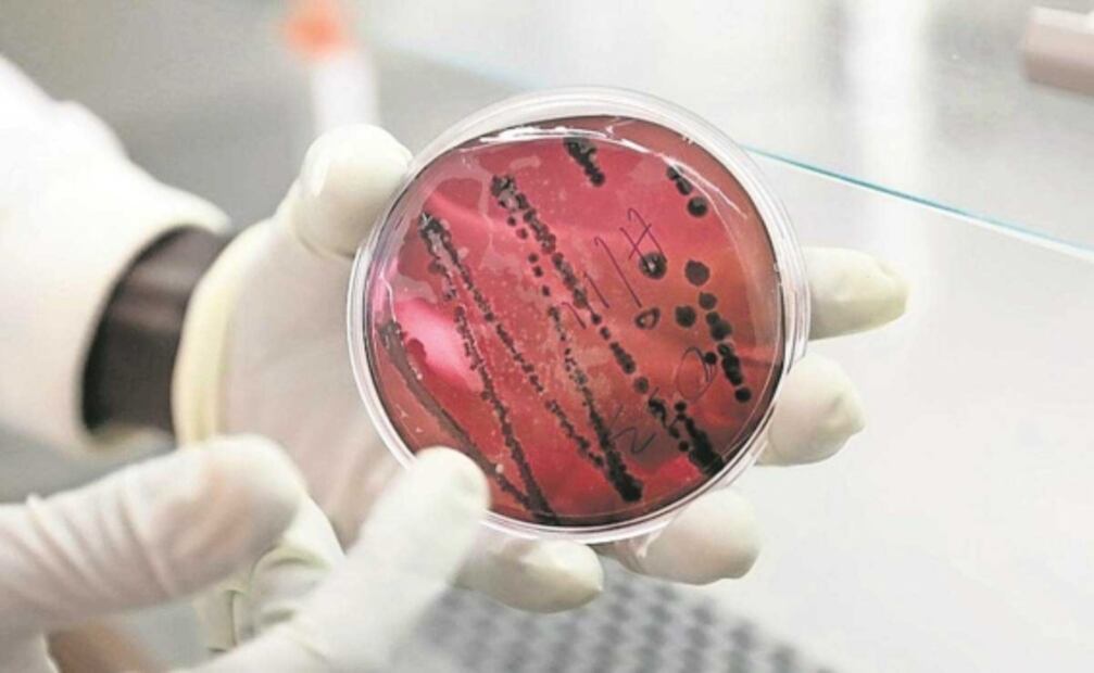 Confirman primer caso importado de viruela del mono en México