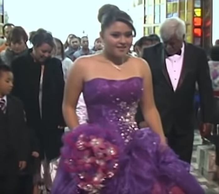 Así era Gomita antes de las cirugías