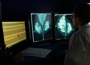 Tecnología 3D para reconstruir senos en mujeres con cáncer