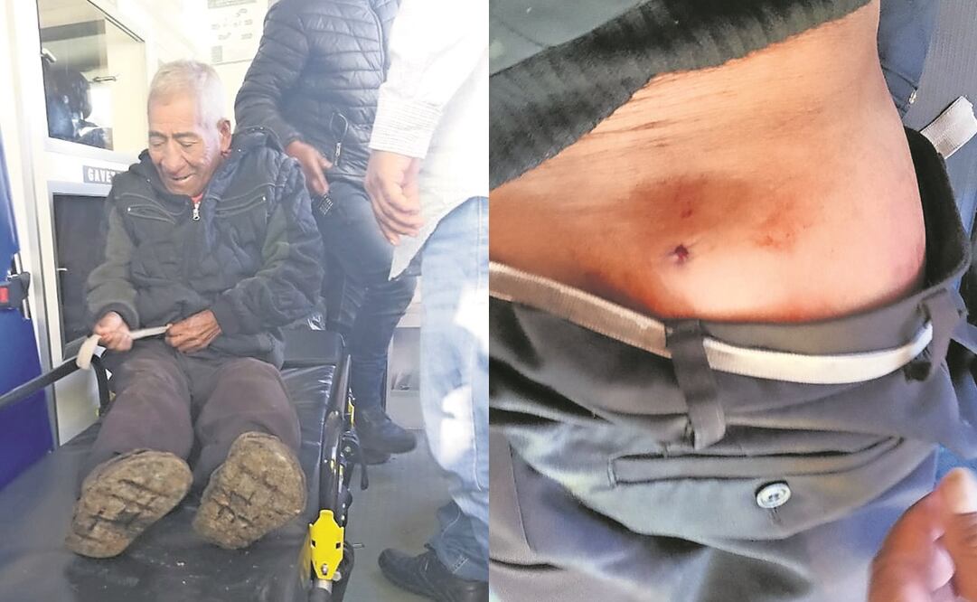 Tomas Lunes Ruiz, de 71 años, fue alcanzado por una bala dentro de su vivienda. Foto: Especial 