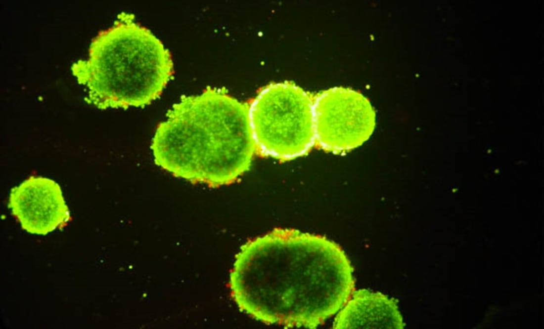 La hepatitis C es una enfermedad del hígado causada por el virus del mismo nombre, que puede originar una infección tanto aguda como crónica. FOTO: Archivo/ EL UNIVERSAL