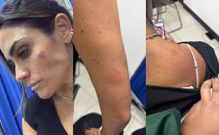 Agreden a alcaldesa Alessandra Rojo y personal de la Cuauhtémoc; señala a gente de Diana Barrios