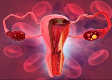 ¿Es el inositol la solución perfecta para el SOP? Esto dice un ginecobstetra 