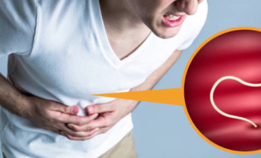 La piña ayuda a eliminar los parásitos intestinales. Foto: Pixabay