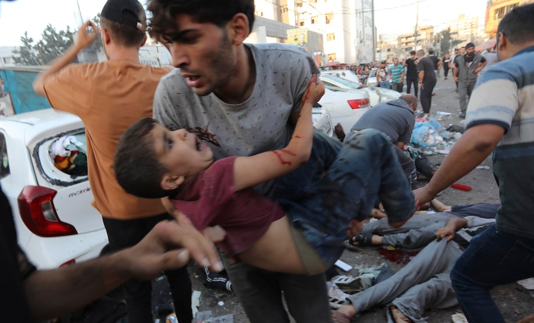 Un niño palestino herido es transportado, tras un ataque aéreo israelí frente a la entrada del hospital al-Shifa en la ciudad de Gaza. Foto: AP