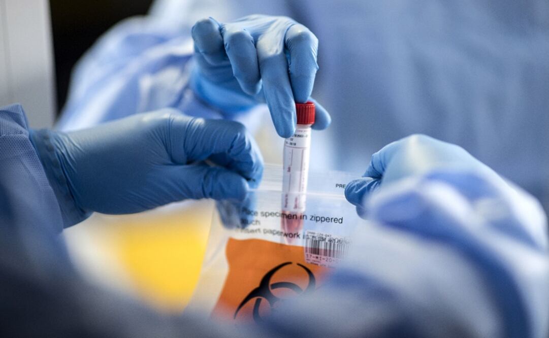 A member of the medical team collects samples of Covid19Mahmoud – Photo: Khaled /EFE/EPA