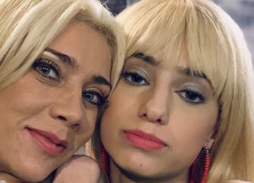 ¿Cirugía estética como regalo de 15 años? Famosas responden a sus hijas