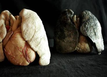 Crece incidencia de cáncer de pulmón en México; fallecen cerca de 8 mil personas por este padecimiento