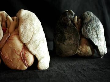 Crece incidencia de cáncer de pulmón en México; fallecen cerca de 8 mil personas por este padecimiento