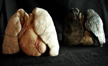 Crece incidencia de cáncer de pulmón en México; fallecen cerca de 8 mil personas por este padecimiento