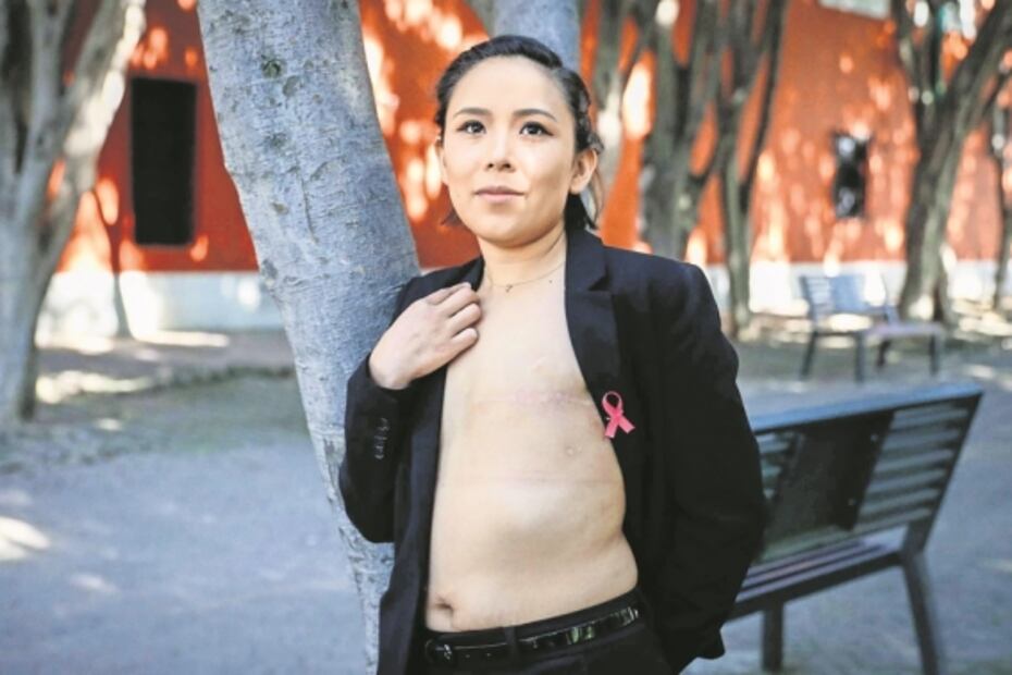 Cáncer de mama. Lorena muestra su cicatriz para invitar a las mujeres a que se exploren