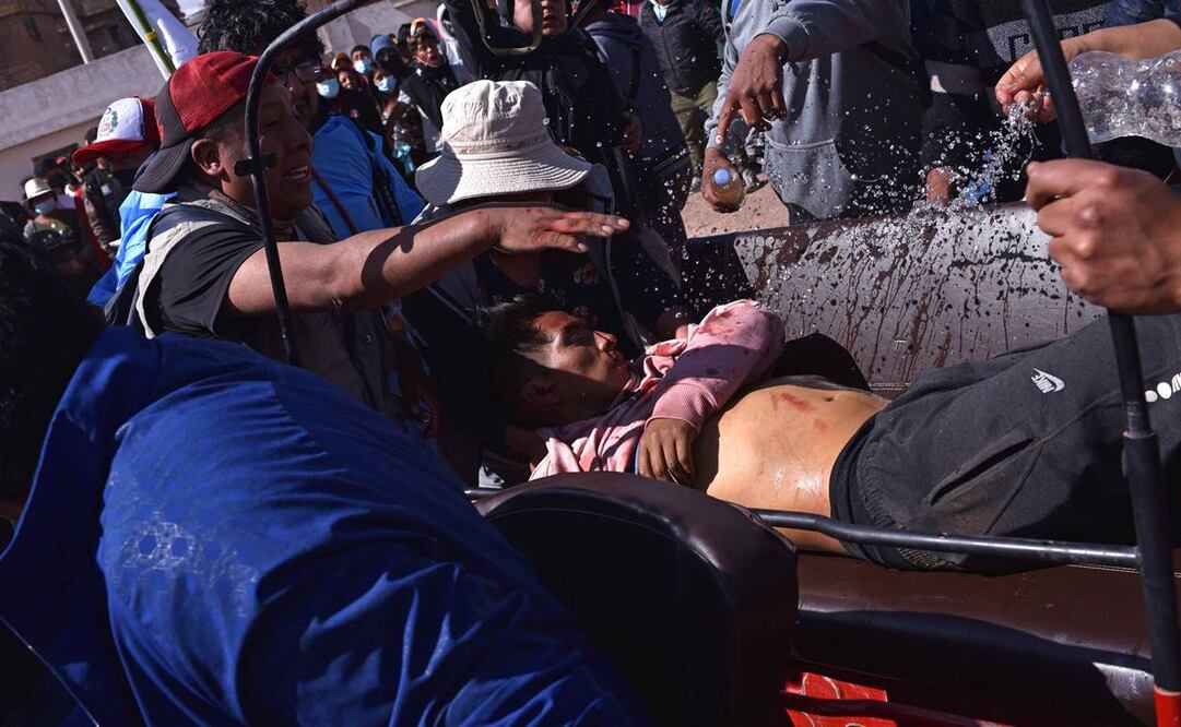 Un herido es trasladado tras los enfrentamientos entre manifestantes y la policía en Juliaca. Foto: EFE