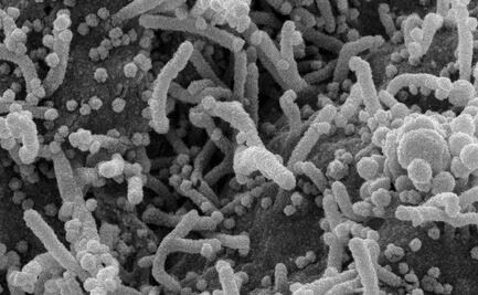 La inmunidad contra el covid-19 puede ser superior a seis meses, según estudio