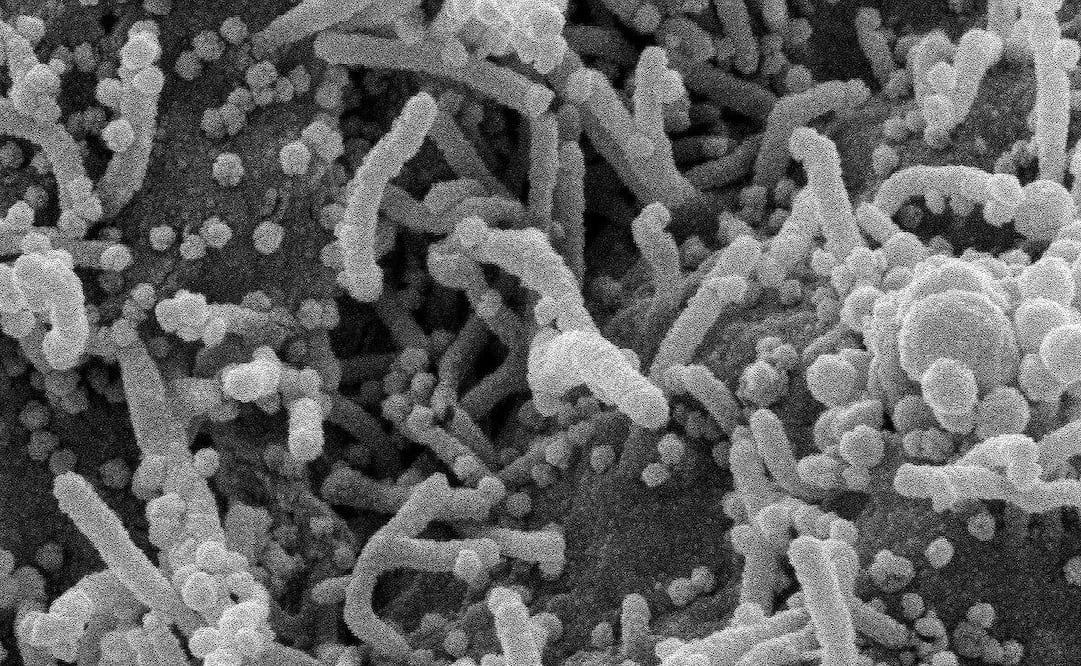 Foto: EFE/EPA/NIAID/NATIONAL INSTITUTES OF HEALTH 