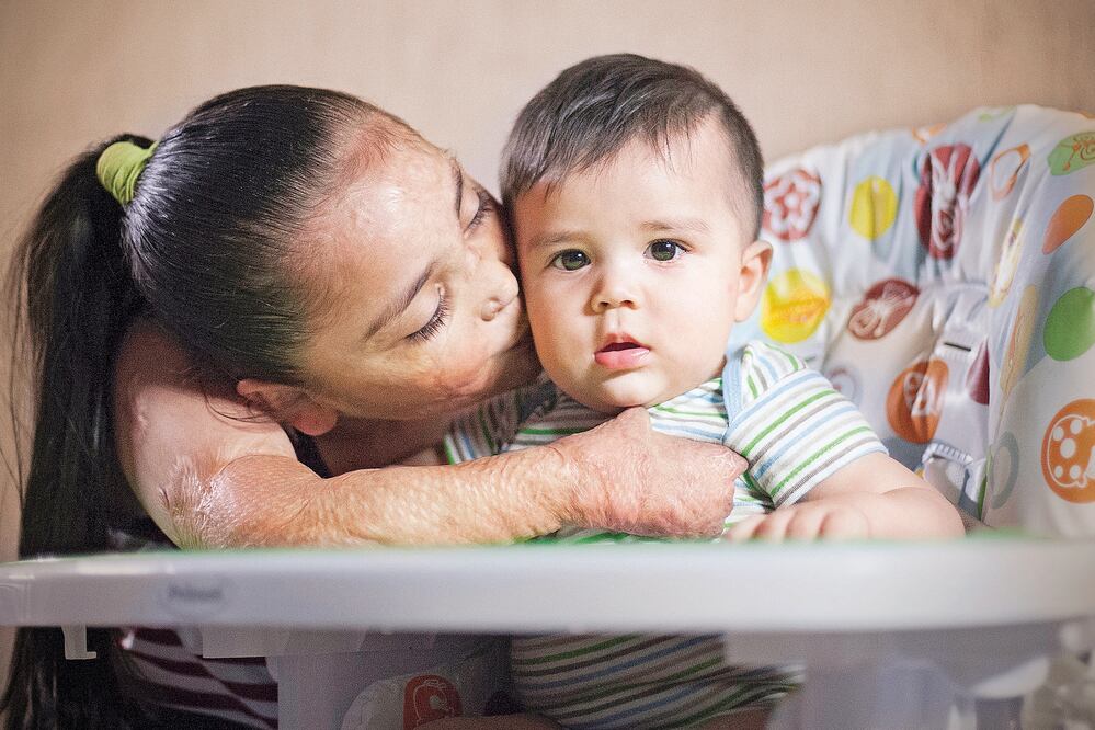 Desde el 5 de junio de 2009, cuando murieron 49 niños y 106 quedaron heridos con secuelas permanentes, los padres recurren a sicólogos y mantienen la lucha para exigir justicia