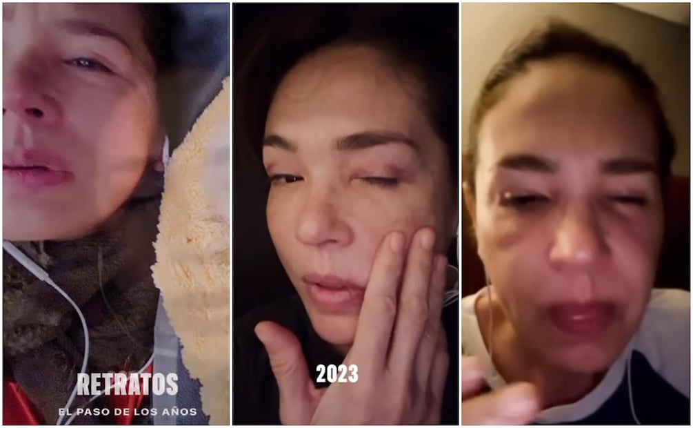 Yolanda Andrade  muestra los efectos de la Esclerosis Lateral Amiotrófica (ELA) en su rostro.