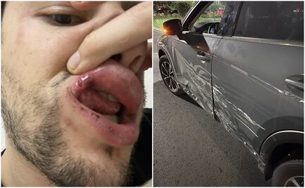 VIDEO: Joven denuncia a policías de CDMX por presunta agresión tras choque en Avenida Universidad