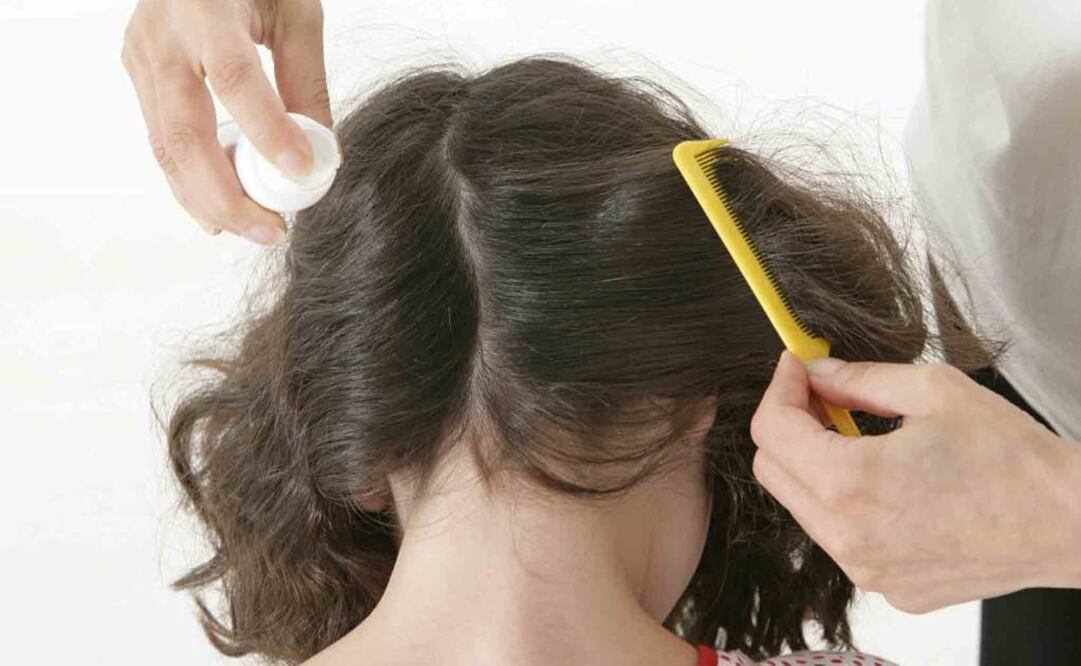 El continuo uso de esas sustancias a través de los años ha provocado que los piojos evolucionen. Foto: Artículo